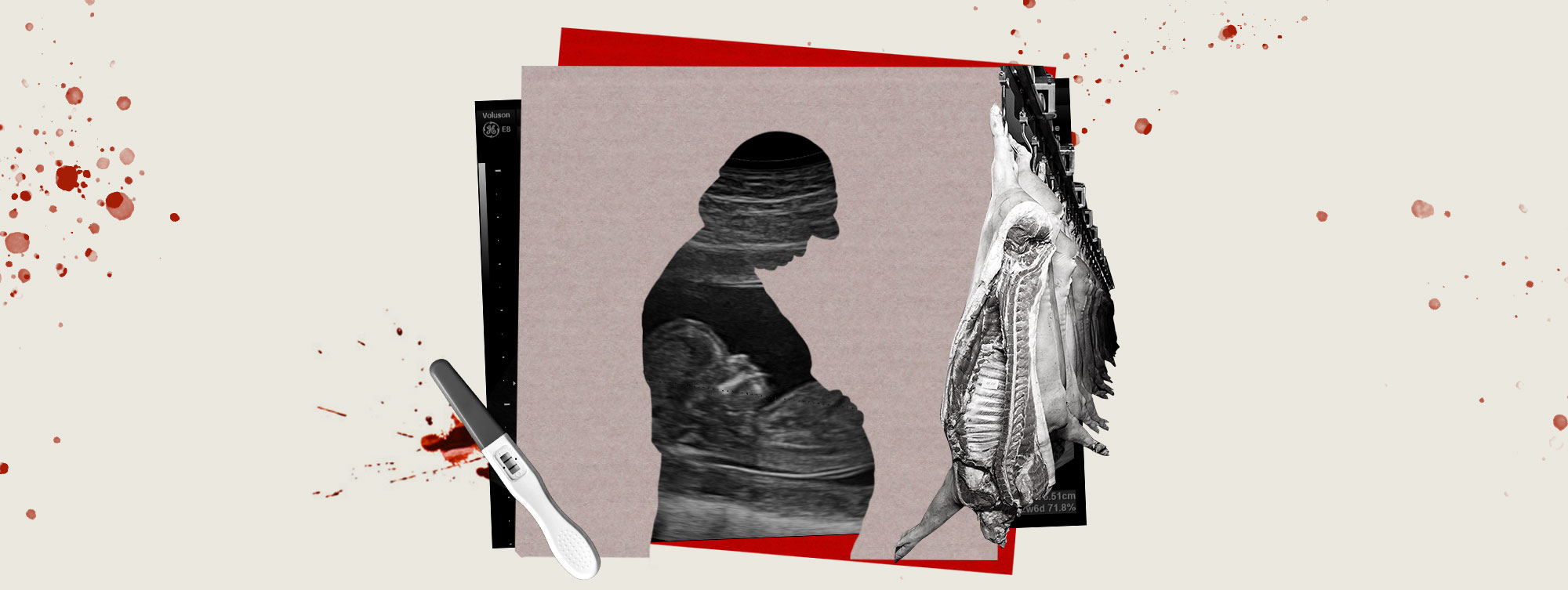 Frigoríficos: indústria da carne que provoca abortos